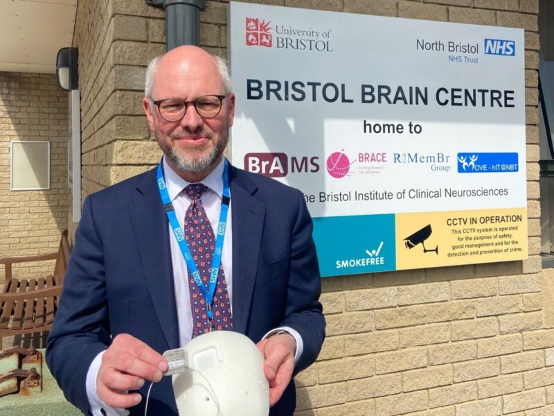 World’s smallest Deep Brain Stimulation device in clinical trials