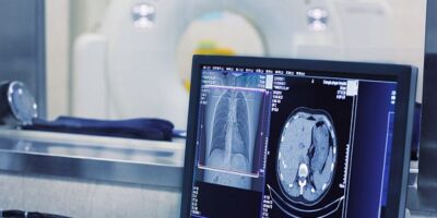 Hypervisor software speeds development of secure medical devices