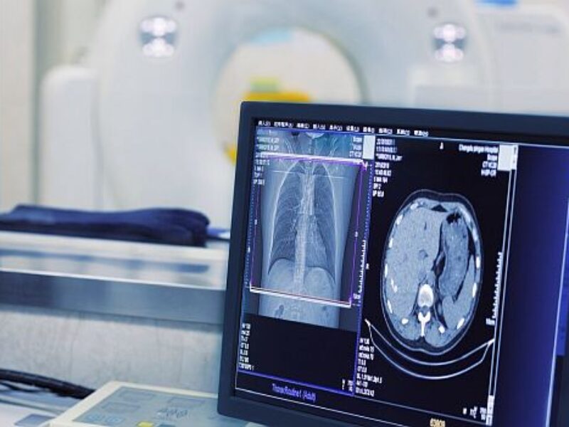 Hypervisor software speeds development of secure medical devices