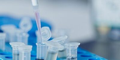 Des nanocapteurs pour diagnostiquer plus rapidement les maladies infectieuses