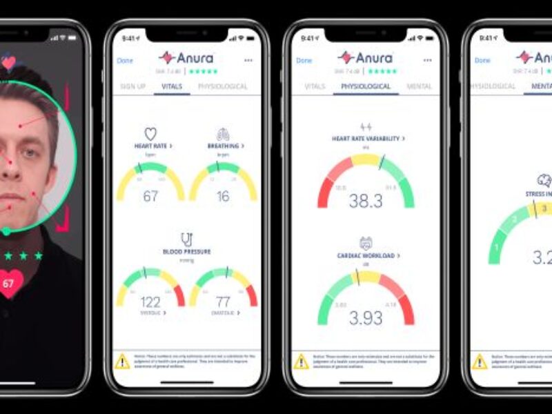 Health AI models predict metabolic risks