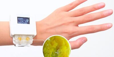 Living smartwatch requires care, feeding