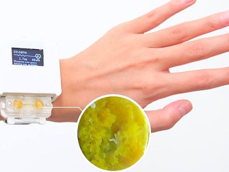 Living smartwatch requires care, feeding