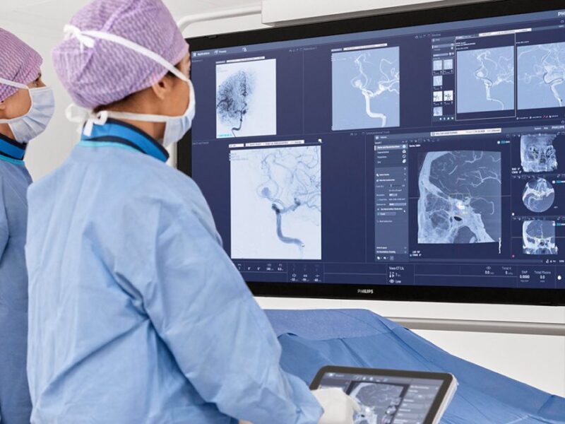 More layoffs at Philips as R&D, procurement restructures