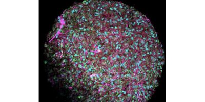 Roadmap shows how ‘wetware’ can power AI computers