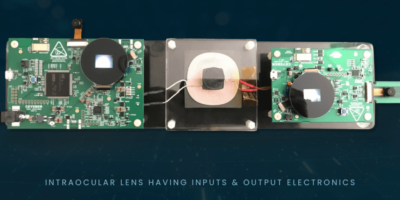 ‘Eye’ can see clearly now