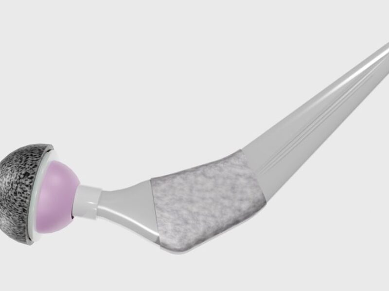 Fully automated six axis laser processing system for implantable medical devices