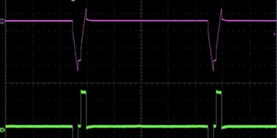 Neuralink shows first ASIC waveforms for brain interface