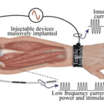 A human-machine interface to stop muscle tremors
