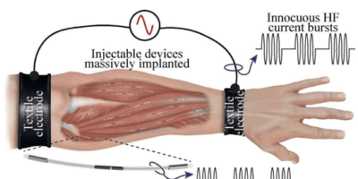 A human-machine interface to stop muscle tremors