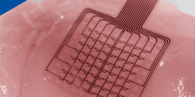 Monitoring brain tsunamis with graphene transistors