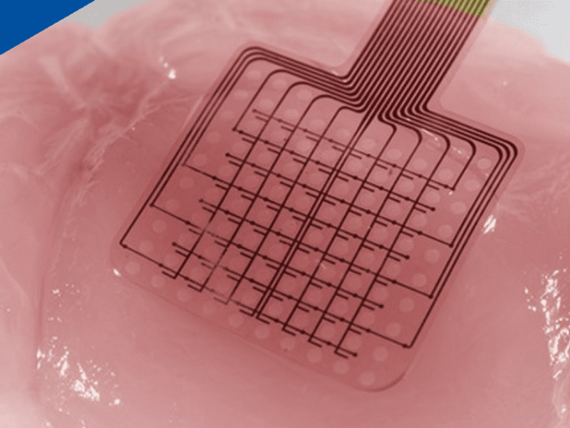 Monitoring brain tsunamis with graphene transistors