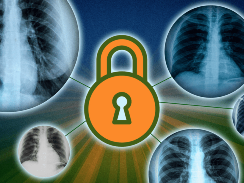 Protect sensitive data with the right amount of noise