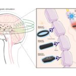 Magnets in the brain could control mood, depression