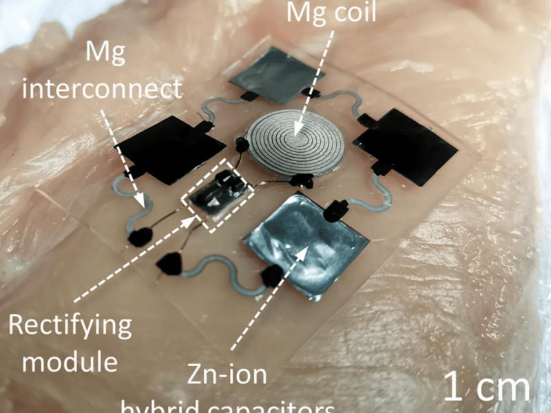 A wireless charger under your skin