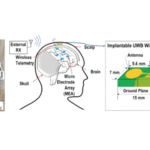 Your body can be a transmitter for high-density brain implants