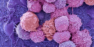 ‘Biocomputer’ combines lab-grown brain tissue with electronic hardware