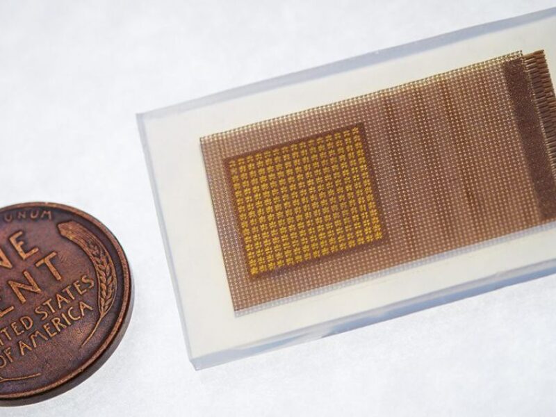 Startup to develop ultrasound patch that measures brain blood flow