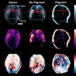Photoacoustic model tackles bias in medical sensors