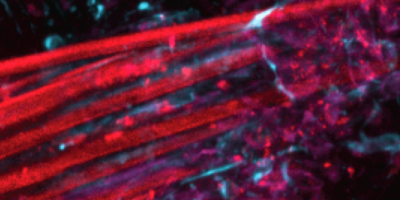 Flexible tentacle electrodes precisely record brain activity