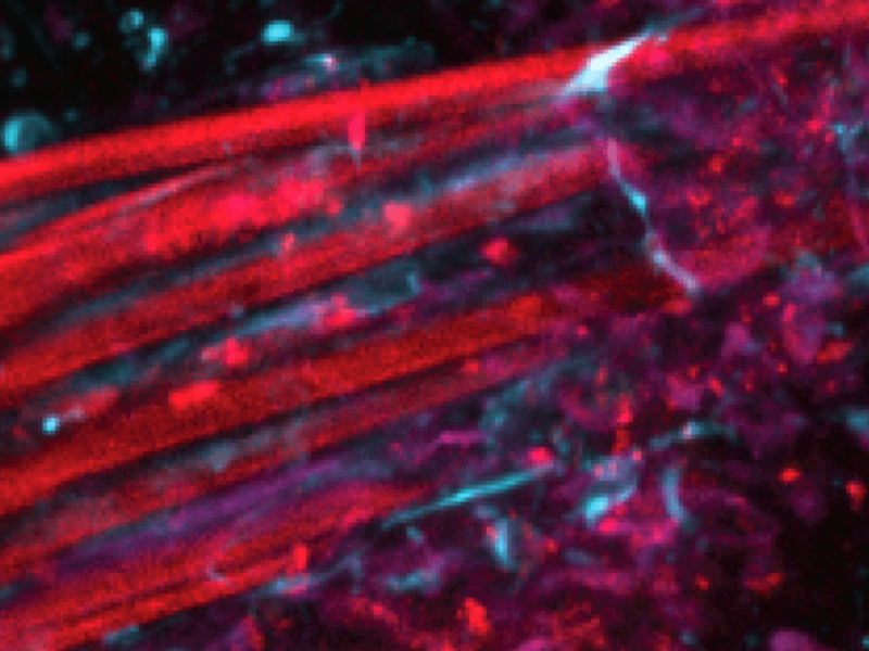 Flexible tentacle electrodes precisely record brain activity