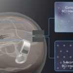 InBrain raises US$50 million for brain-computer interface