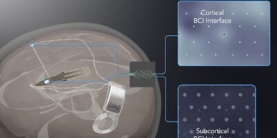 InBrain raises US$50 million for brain-computer interface