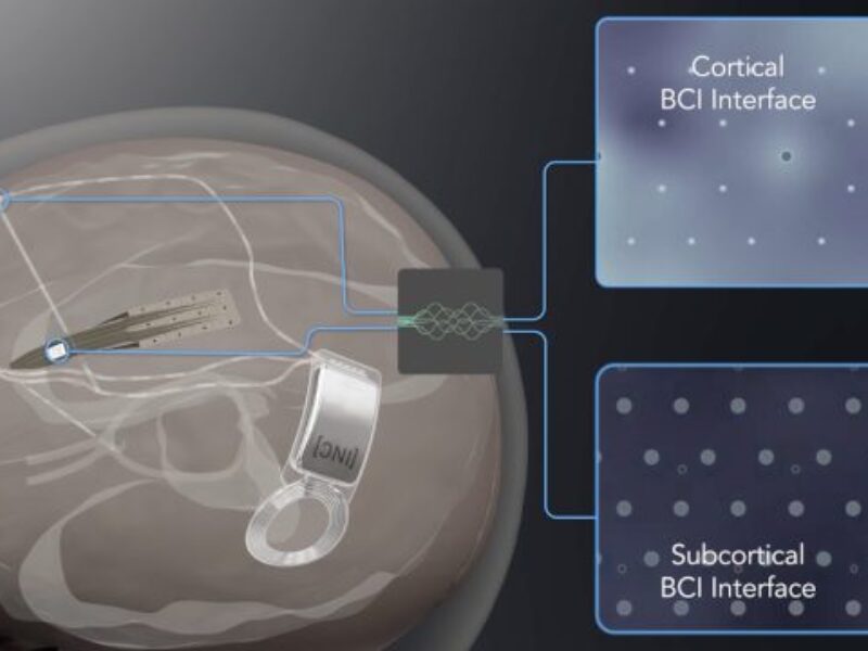 InBrain raises US$50 million for brain-computer interface