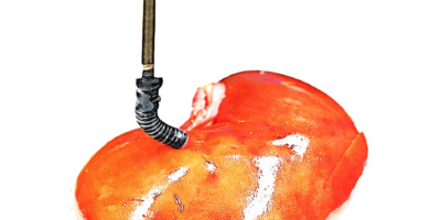 New electricity-free soft robot could aid precise surgery