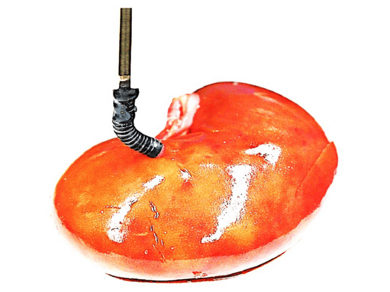 New electricity-free soft robot could aid precise surgery