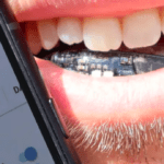 Battery-free sensor brace unveils crucial health data via smartphone