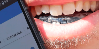 Battery-free sensor brace unveils crucial health data via smartphone