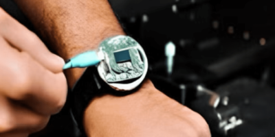 No more needles! Tracking blood sugar on your wrist