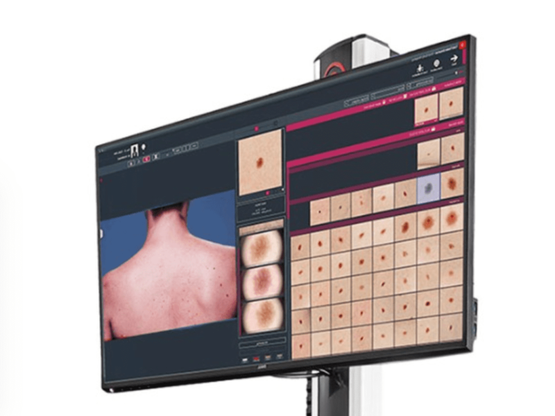 Fast, reliable Skin Cancer detection with AI