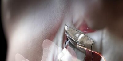 Ultrasonic wireless charging for implantable devices