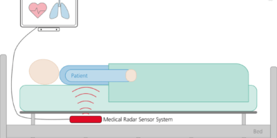 A radar ECG can monitor the patient – no electrodes required
