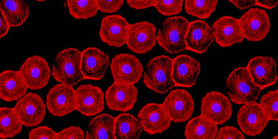 Les dernières avancées dans la technologie CMOS peuvent-elles remplacer les capteurs sCMOS dans les applications biomédicales ?