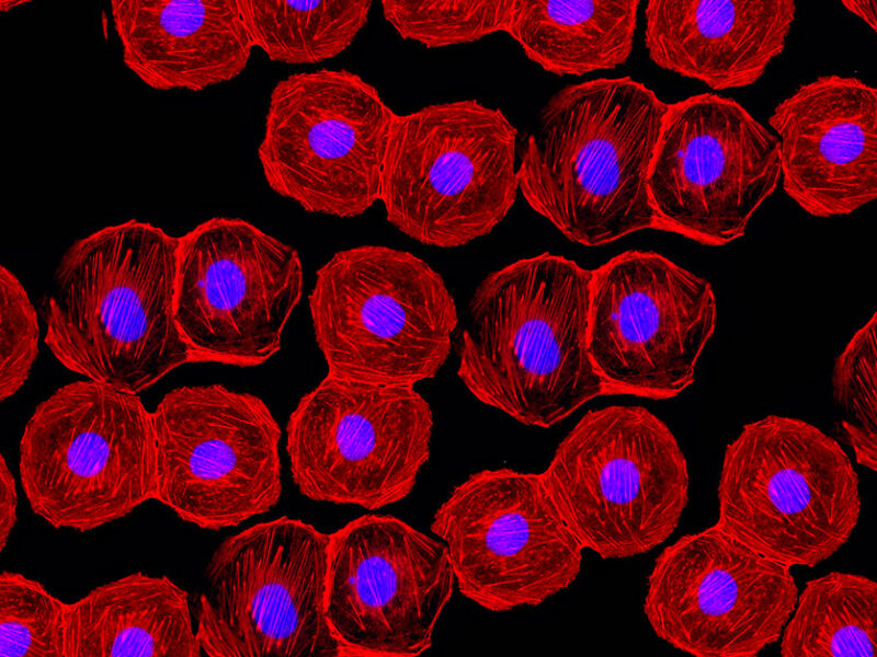Les dernières avancées dans la technologie CMOS peuvent-elles remplacer les capteurs sCMOS dans les applications biomédicales ?