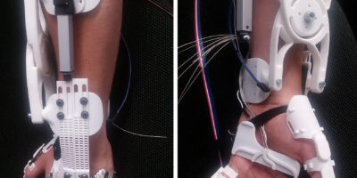 Exoskeleton makes paralyzed hand functional again