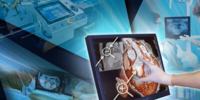 Resistive multi-touch becomes reality