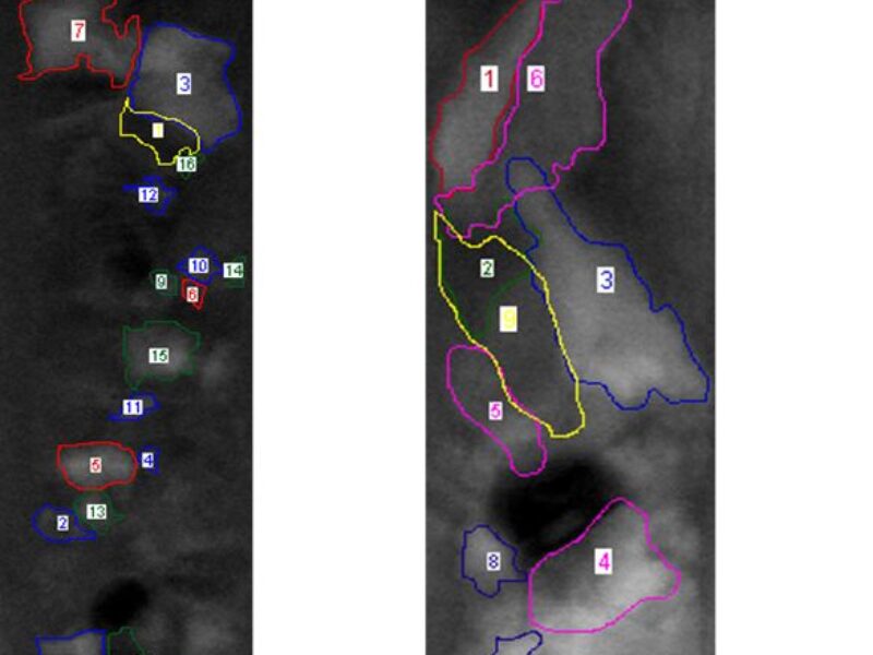 Laser thermal anneal to boost performance of 3D memory devices