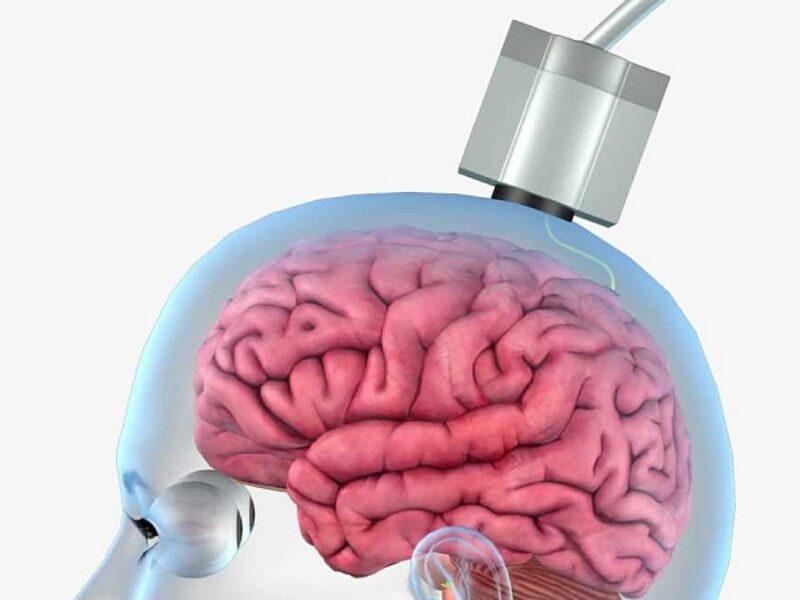 Wireless ‘thought into action’ brain sensor begins benchtop testing