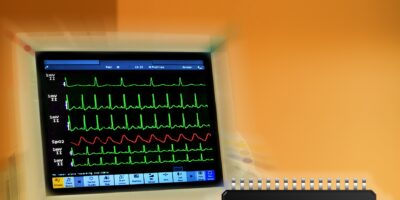 Sous-système frontal intégré pour électrocardiogrammes de qualité diagnostic