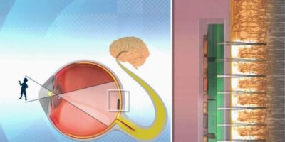 Designing an artificial retina for sight restoration