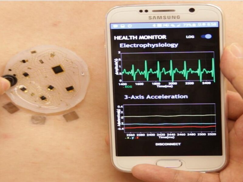 Electronic ‘skin’ tracks health data
