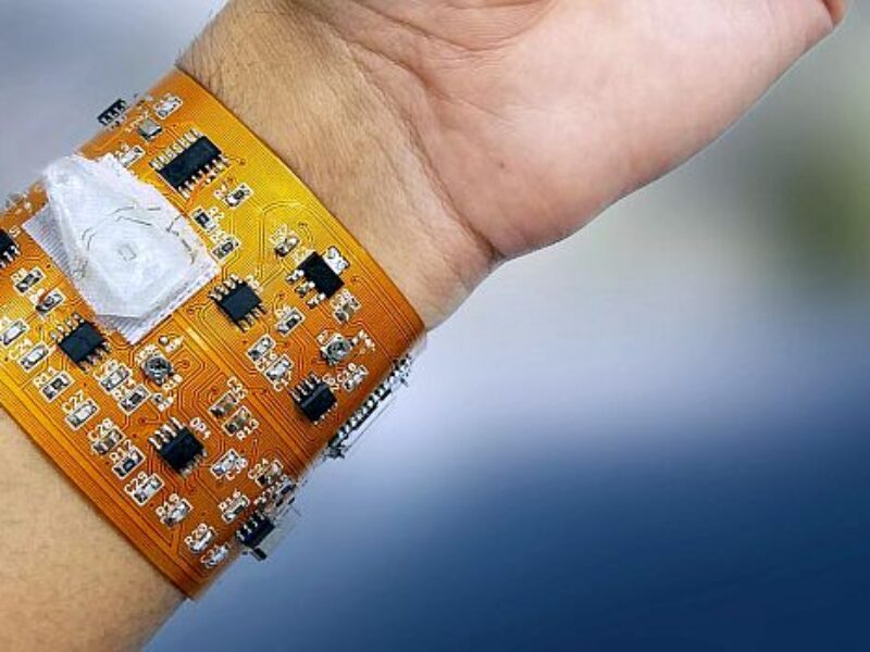Smart wristband brings blood monitoring to wearable devices