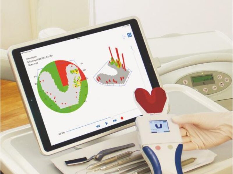 Heidelberger lance la production d&rsquo;électronique organique imprimée