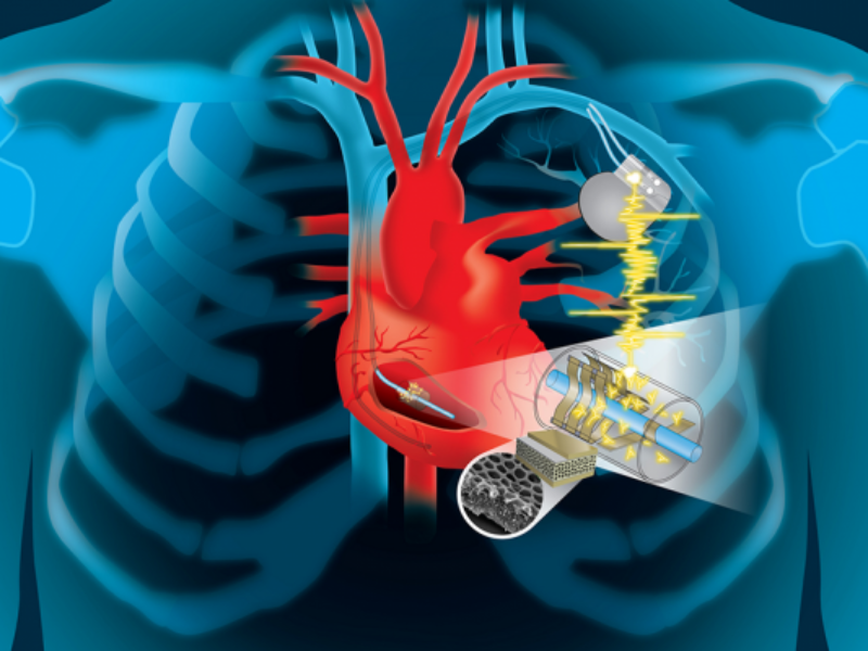 Piezo-based energy harvesting within medical implants