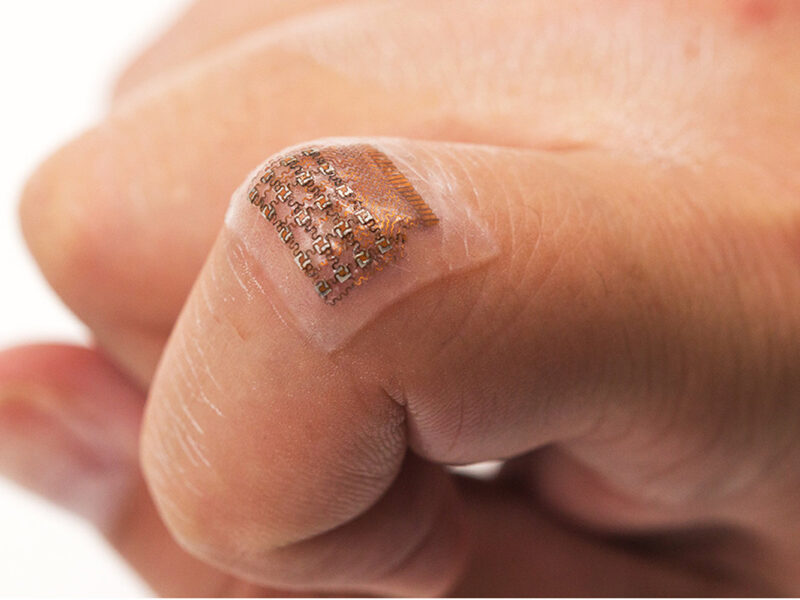 Skin-worn ultrasound patch can flex and stretch