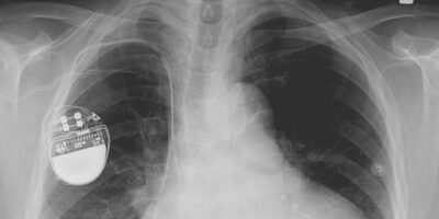 Ultrathin piezoelectric energy harvester is cheap to produce